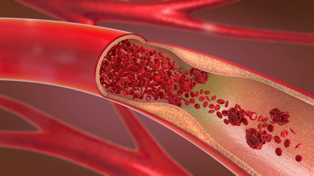 Cirurgia Vascular