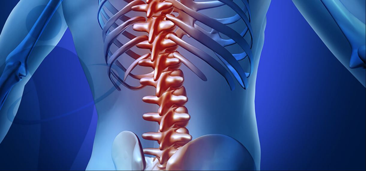 Cirurgia de Coluna